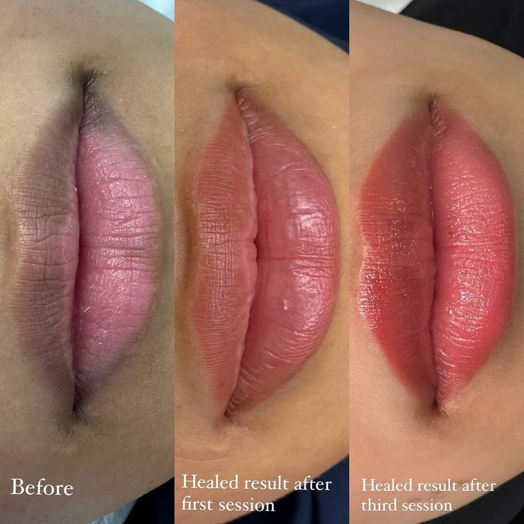 توريد شفايف